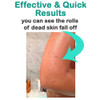 Elbahya Exfoliating Mitt Body Kessa Hammam Body Tool Remover of Dead Dry Skin or Keratosis Pilaris Made of 100 Viscose F