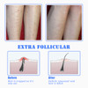 TailaiMei Exfoliating Brush for Ingrown Hair Treatment to Treat and Prevent Bikini Bumps Razor Bumps Silky Smooth Skin S
