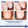 Cuticle Remover Softener Liquid for Nails Blue Cross Professional Nail Care with Lanolin Hydrating Treatment for Dry Cut