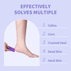 NOVAL Pumice Stone for Feet Scrubber Dead Skin Disposable Foot Pumice Foot Callus Remover Pedicure Tools Purple Pumice S