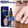 6PCs German Toenailcare Removal Paronychia Oil Ingrown Toenail Nail Repair German Toenailplus Oil Nail Renewal Liquid