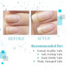 Nail Tek Renew Natural Cuticle Oil with Tea Tree for All Nail Types 048 oz 1Pack