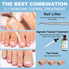 Ingrown Toenail Treatment wIngrown Toenail Drops Reliever SoftenerDouble Sided Pedicure Nail Lifter Tool for Easy Trimmi
