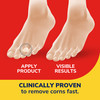 Dr Scholls Corn REMOVERS Seal Heal Bandage with Hydrogel Technology 18 ct Removes Corns Fast and Provides Cushioning Pro