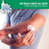 Miracle of Aloe Aloe All Over Super Moisturizing Dry Skin Lotion 8 oz Made with 72 UltraAloe Aloe Vera Gel Safe for Ever