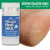 2 Pack Heel Balm for Dry Cracked Feet Miracle Heel Stick for Cracked Heel Repair Cracked Heel Treatment Formulated with