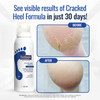 FOOTLOGIX Cracked Heel Formula White 423 Ounce