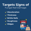 Kerasal Nighttime Renewal Fungal Nail Patches 14 Patch Twin Pack Overnight Nail Repair for Nail Fungus Damage 8Hour Nail