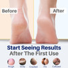 Yellow Bird Natural Tea Tree Foot Cream Organic Foot Balm for Dry Cracked Feet Heels Peppermint Moisturizer for Athletes