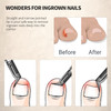 FERYES Toenail Clipper Straight Blade for Ingrown and Thick Nails Stainless Steel and Sharp Pointed Tip Ingrown Nail Cli