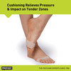 PROFOOT InterMetatarsal Pads Neuroma Ball of Foot Cushions for Women Men for Foot Pain Relief Helps Reduce Tingling Burn