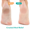 GILDEN TREE Urea Gel 42 Percent For Feet Maximum Strength Softens Cracked Heel Calluses Thick Toenails