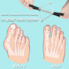 Tondiamo Pilates Toe Stretcher Bunion Hallux Valgus Big Toe Strap Spacer Tension Bunion Exercise Band Stretchy Alignment