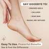 Pumice Stone for Feet Natural Lava Stone Foot Exfoliator Callus Remove for Feet Hands Dead Skin Foot Scrubber for Pedicu