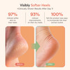 ZenToes Moisturizing Socks for Cracked Heel Treatment Vitamin E Olive Oil and Jojoba Oil Infused Heel Socks Galentines D