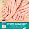 Toenail Fungus Extra Strength SolutionThick Discolored Nail Repair Ingrown Nails Dry Cracked Nails CuticlesAll Natural w