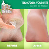 Miracle Foot Repair Cream 32 oz Repairs Dry Cracked Heels and Feet 60 Pure UltraAloe Moisturizes Softens and Repairs
