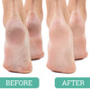 Maccibelle Salon Foot Pumice and Scrubber for Feet and Heels Callus and Dead Skins Safely and Easily Eliminate Callus an