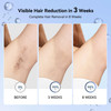 Laser Hair Removal for Women IPL Laser Hair Removal Device Painless Hair Remover at Home with Sapphire IceCooling LongLa