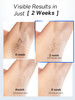 Blex Laser Hair Removal for Women and Men IPL Laser Hair Removal Device with Permanent Results Effective in 2 Weeks Ultr