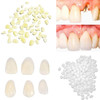 Tooth Repair KitThermal Fitting Beads Granules and Fake Teeth for Temporary Fixing Missing and Broken ToothReplace a Mis