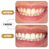 Lumineux Teeth Whitening Strips 21 Treatments 3 Months Peroxide Free Enamel Safe for Whiter Teeth Whitening Without The