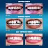 Imako Tooth Tinted Plastic Natural Color Temporary Tooth Made in USA