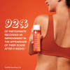BioOil Skincare Body Oil Serum for Scars and Stretch Marks Face and Body Moisturizer with Vitamin E A for Sensitive Dry