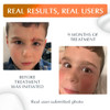 MyNewGel Plus UV Advanced Silicone Scar Gel Old New Scars SPF30 Mineral nonchemical Sunscreen Ideal for Protecting Scars