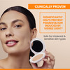 Avne High Protection Beige Tinted Compact Broad Spectrum SPF 50 UVAUVB Blue Light Protection Tinted sunscreen 100 Minera