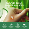 ORISO Aloe Vera Gel With Cold Pressed Aloe Vera Pure Sunburn Relief Bug Bites Small Cuts Soothing Moisturizer Lotion For