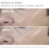 SkinMedica Total Defense Repair SPF 34 Sunscreen for Face This Lightweight Facial Sunscreen is Ideal for Oily andor Comb
