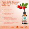 Bella Terra Oils - Organic Rosehip Seed Oil 2 oz - Cold-Pressed Elixir, Rich in Vitamin A, C, & E, Linoleic & Alpha-Linolenic Acid, Perfect Facial Em online at globaldelivered