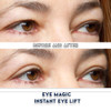 Eye Magic Premium Instant Eyelid Lift L/XL-Refill. Look Younger Instantly Made in America - Lifts