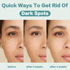 CITYGOO Dark Spot Remover for Face Dark Spot Corrector Cream - Enriching Skin Care For All Skin