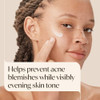 Aveeno Positively Radiant Clear Complexion Acne Face Moisturizer, 4 fl. oz