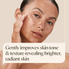 Aveeno Positively Radiant Clear Complexion Acne Face Moisturizer, 4 fl. oz