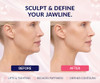 Stylia V Line Lifting Collagen Mask - Lift, Firm & Contour Jawline - Tightening Double Chin Strap with Hyaluronic Acid