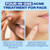 Differin Acne Spot Treatment, Max Strength, 10 Benzoyl Peroxide, 1oz