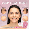 VIABEAUTY 8 Pack of Collagen Face Mask with Ceramides - Rejuvenating Facial Sheet Mask, Reduce Wrinkles & Fine Lines -