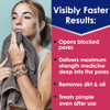 Clearasil Rapid Rescue Deep Treatment Acne Face Pads, Maximum Strenght with 2% Salicylic Acid Acne Treatment Medicine,