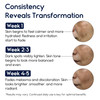 Melasma Treatment for Face - Melasma Cream & Age Spot Remover for Skin Discoloration, Post-Blemish Marks, Scars &