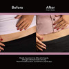 GoodSense ScarAway Advanced Skincare Silicone Scar Sheets for C-Sections, Reusable Sheets (1.5 x 7) for Hypertrophic