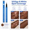 ZHEZHI Waterproof Vitiligo Concealer Pen (Brown to Deep Skin Tone, Face and Body)