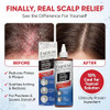 Tarsum Extra Strength Psoriasis Shampoo Coal Tar Shampoo And Conditioner For Scalp Psoriasis Seborrheic Dermatitis Severe Dandruff And