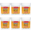 De La Cruz 10 Percent Sulfur Ointment Cystic Acne Treatment 2.6Oz Jar 6 Pack