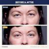 Eye Magic Premium Original Eye Lift Kit Medium Kit Size 64 Count Strips Plus Wax Gel Original Premium Kit Made In Usa