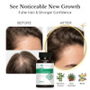 Natural Wellbeing Hair Essentials Dht Blocker Hair Growth Supplement For Women And Men Saw Palmetto Biotin Vegan Capsules Stops Shedding And