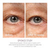 Epionce Renewal Eye Cream Anti Aging Under Eye Cream Dark Circles Puffiness