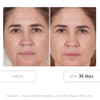 Serious Skincare Glycolic Acid Resurfacing Facial Pads Exfoliates Skin